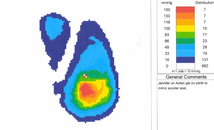 Pressure Mapping Image 1