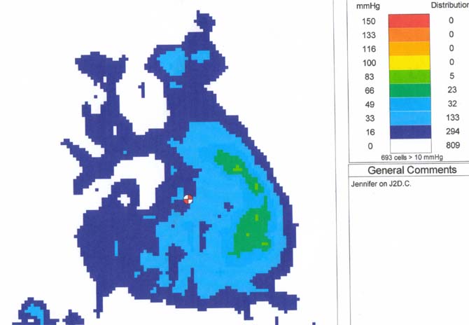 Pressure Mapping Image 2